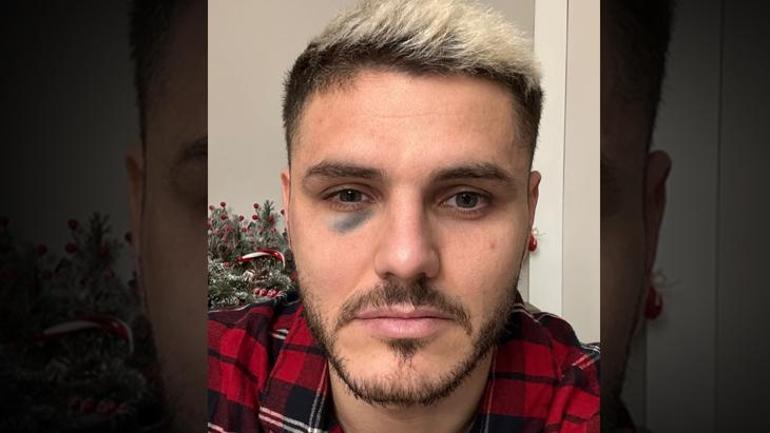 Edin Dzekodan Mauro Icardi cevabı Penaltı için ağlıyorlar