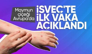 Maymun çiçeği virüsü İsveç’te görüldü