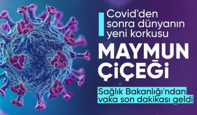 SON DAKİKA! Sağlık Bakanlığı’ndan maymun çiçeği açıklaması: Vakaya rastlanmadı