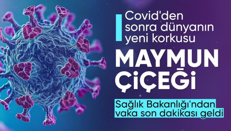 SON DAKİKA! Sağlık Bakanlığı’ndan maymun çiçeği açıklaması: Vakaya rastlanmadı