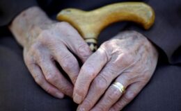 Dünyada 55 milyondan fazla kişi Alzheimer