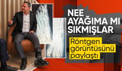 Özgür Özel ayak röntgen filmlerini paylaştı