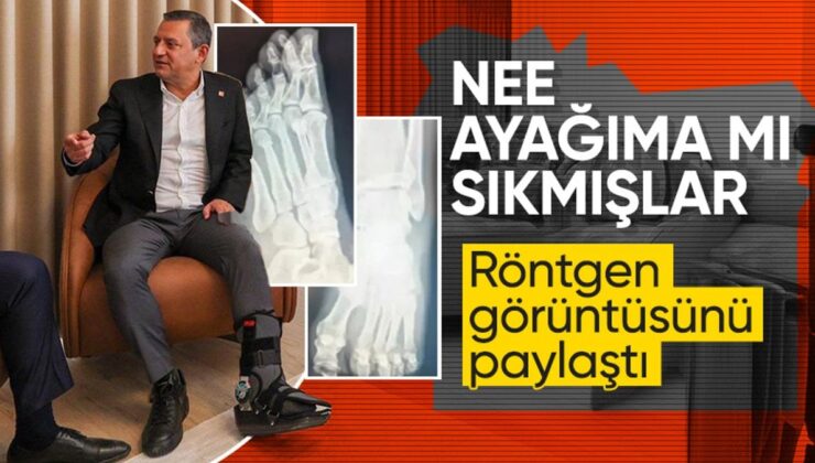 Özgür Özel ayak röntgen filmlerini paylaştı