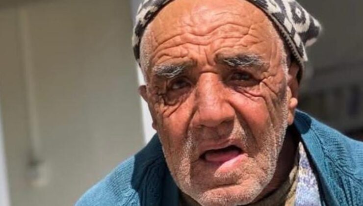 Ankara’da otomobilin çarptığı adamdan kötü haber