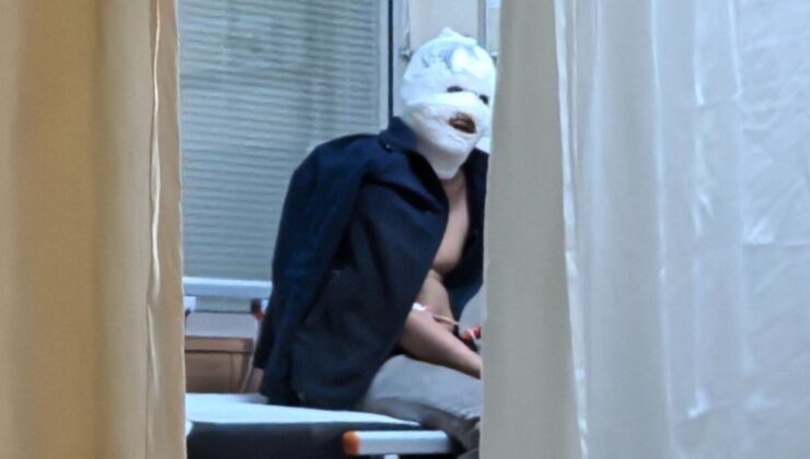 Bursa’da benzinle sobayı tutuşturmaya çalıştı