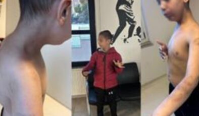 İstanbul, Beylikdüzü’nde özel bakım merkezinde otizmli çocuğa şiddet iddiası