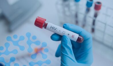 İstanbul’da evlenmeden önce HIV pozitif olduğunu eşinden sakladı: Kasten öldürmeye teşebbüsten dava açıldı