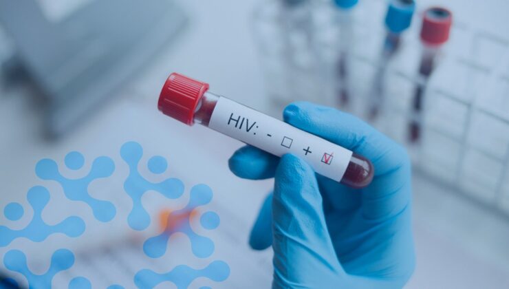 İstanbul’da evlenmeden önce HIV pozitif olduğunu eşinden sakladı: Kasten öldürmeye teşebbüsten dava açıldı