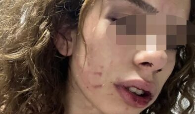 Konya’da kız arkadaşına işkence yaptı serbest kaldı