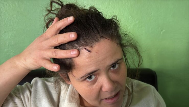 Muğla’da kendisini darbeden eşi serbest bırakıldı: Can güvenliğimden endişeliyim