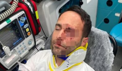 Aksaray’da darbettiği imamı telle boğmaya çalıştı