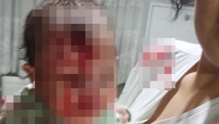 Ankara’da 4 aylık bebeğini cam sehpaya fırlatıp yaraladı