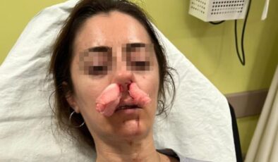 Edirne’de şaşkına çeviren olay: Kocasının sevgilisine benzettiği kadını darbetti