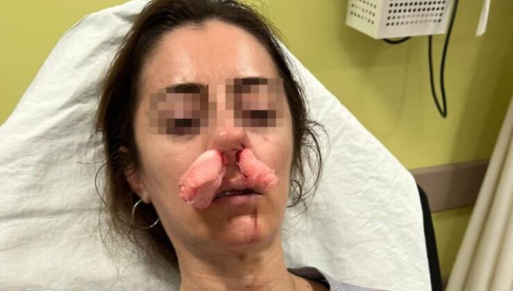 Edirne’de şaşkına çeviren olay: Kocasının sevgilisine benzettiği kadını darbetti