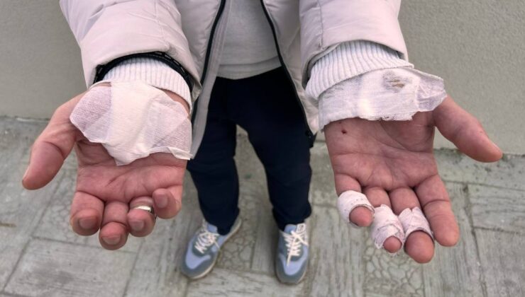 Esenyurt’ta sokakta beslenen köpekler yoldan geçenlere saldırdı