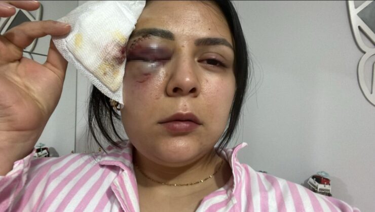 Kahramanmaraş’ta yürürken saldırıya uğrayan genç kız konuştu