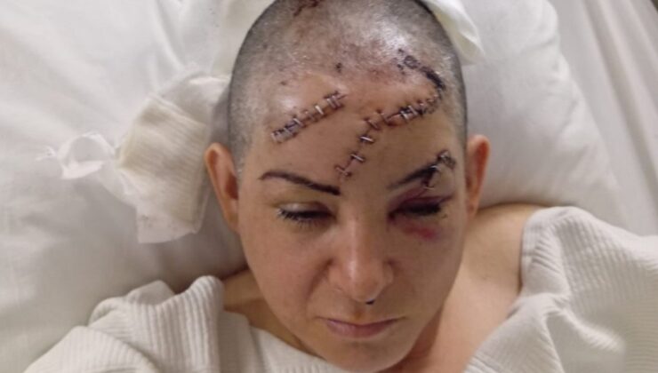 Nevşehir’de eşi satırla saldırdı: Öleceğimi düşündüm