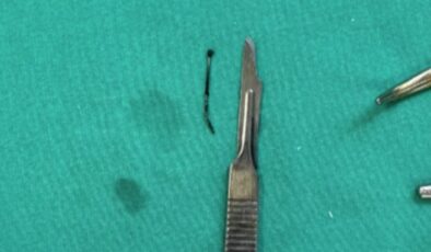 Bitlis’te 5 yaşındaki çocuğun yuttuğu toplu iğne çıkarıldı