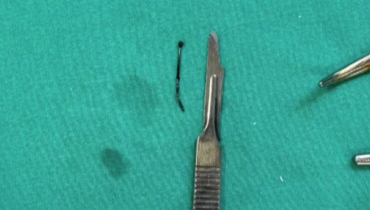 Bitlis’te 5 yaşındaki çocuğun yuttuğu toplu iğne çıkarıldı