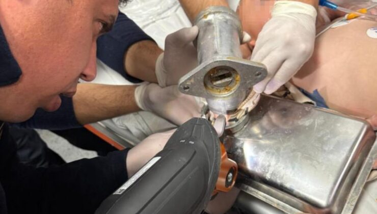 Hatay’da 2 yaşındaki çocuk elini kıyma makinesine kaptırdı