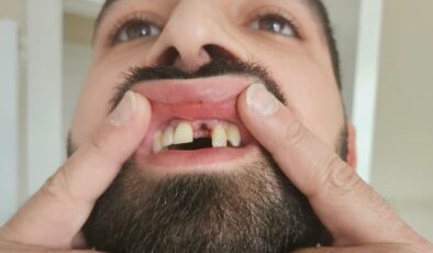 İstanbul’da tahsilat için gittiği pilavcıda darp edildi