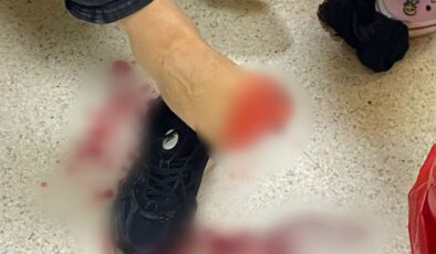 Samsun’da uyuşturucu operasyonunda ateş açılan 2 polis yaralandı