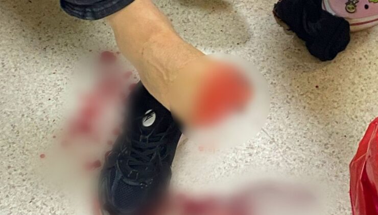 Samsun’da uyuşturucu operasyonunda ateş açılan 2 polis yaralandı