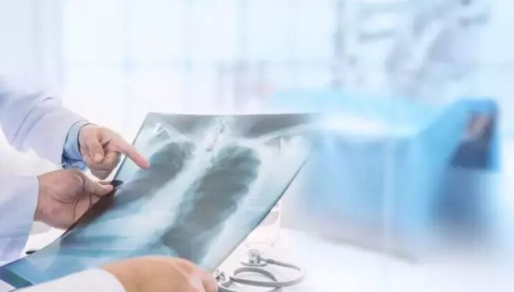 Zatürrenin belirtileri, bulaşma yolları, korunma yöntemleri