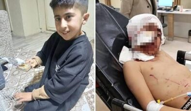 Erzurum’da 10 yaşındaki çocuğa başıboş köpek saldırdı