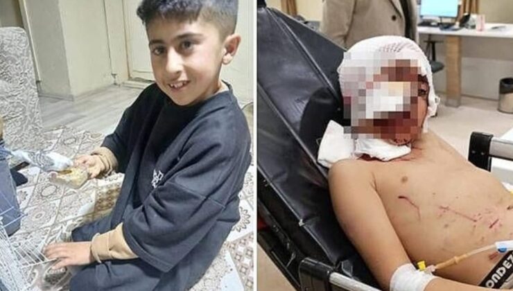 Erzurum’da 10 yaşındaki çocuğa başıboş köpek saldırdı