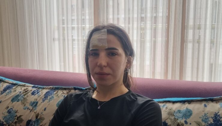 İstanbul’da başıboş köpek dehşeti: 3 tane zımba dikiş attılar