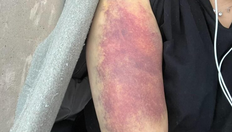 İstanbul’da eski sevgili dehşeti: Evinin kapısını kırdı, boğazını sıkıp darbetti