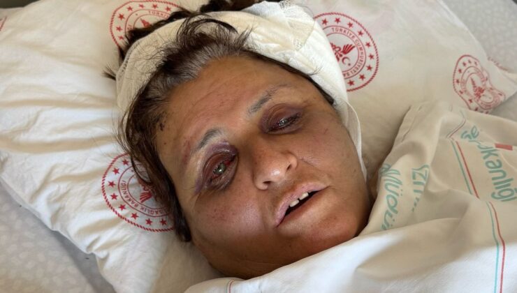 İzmir’de gelinin tuğlayla darbettiği kadın komadan uyandı