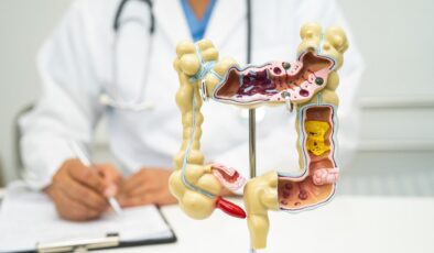 Kolon kanseri belirtileri ve hastalıktan korunma yolları