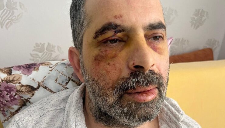 Konya’da köpeklerden kaçarken bisikletten düşüp, yaralandı