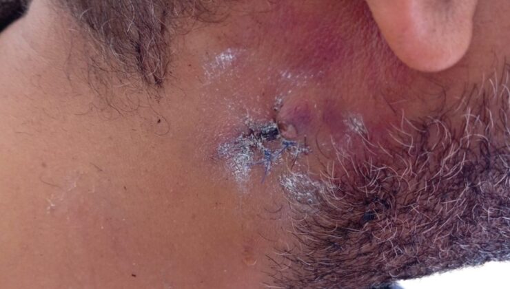 Mardin’de 1 kişinin yaralandığı kavganın görüntüleri ortaya çıktı