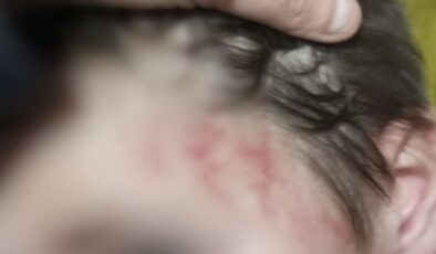 Muğla’da otizmli çocuğunu darbettiği iddia edilen babaya hapis cezası