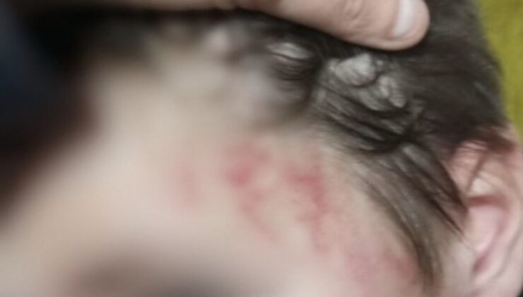 Muğla’da otizmli çocuğunu darbettiği iddia edilen babaya hapis cezası