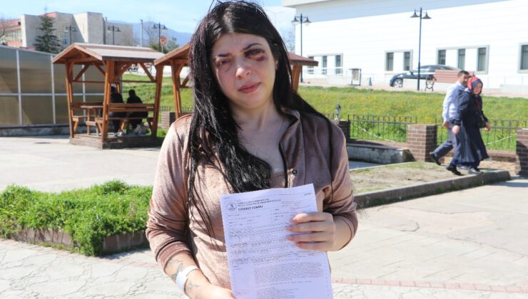 Samsun’da sokak ortasında darbedilen Damla: 3 ay sıvı ile besleneceğim