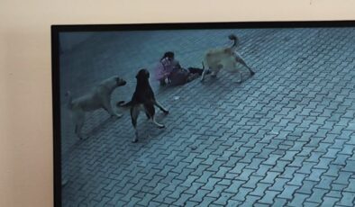 Sivas’ta küçük çocuk sokak köpeklerinin saldırısında yaralandı