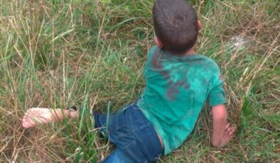 Yalova’da çocuğun köpek saldırısına uğraması olayına soruşturma