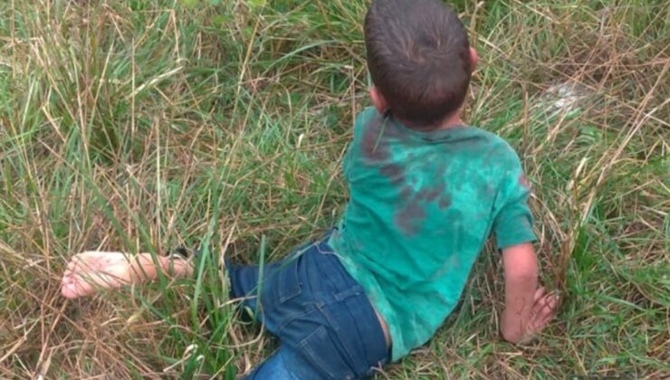 Yalova’da çocuğun köpek saldırısına uğraması olayına soruşturma