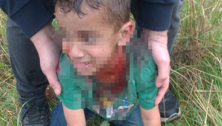 Yalova’da sokak köpeği saldırdısı: 5 yaşındaki çocuğun durumu ağır