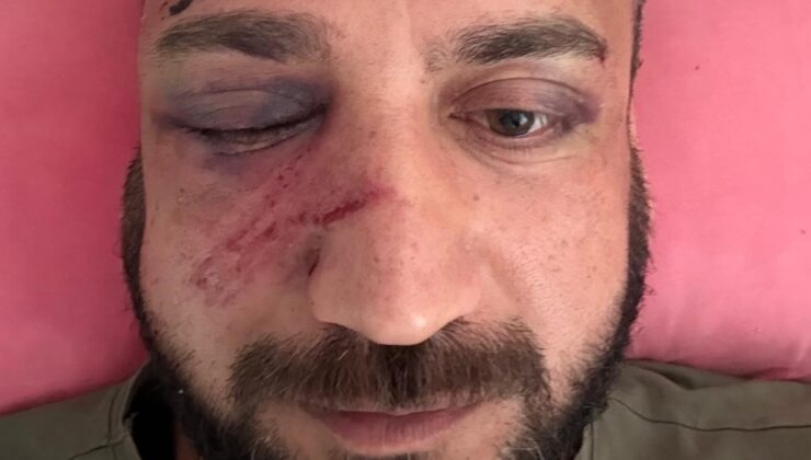 Adana’da borcunu ödemeyen eski sevgilisini icraya verince darbedildi