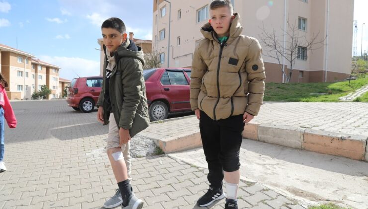 Ankara’da başıboş köpeklerin saldırdığı çocuk dehşet anlarını anlattı