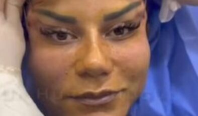 Antalya’da 220 bin TL’ye estetik oldu, hayatı kabusa döndü