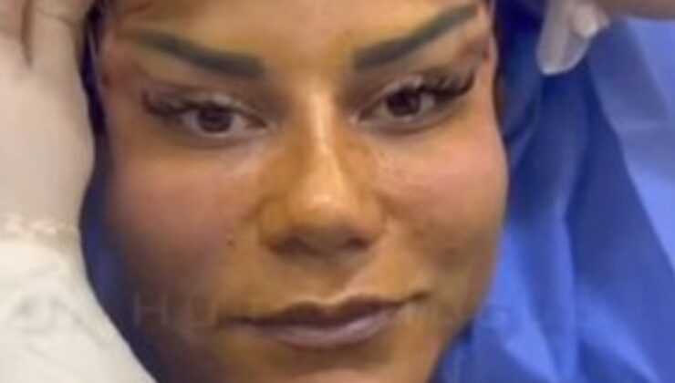 Antalya’da 220 bin TL’ye estetik oldu, hayatı kabusa döndü