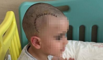 Kadıköy’de anaokulunda kaydıraktan düşen çocuk, ölümden döndü