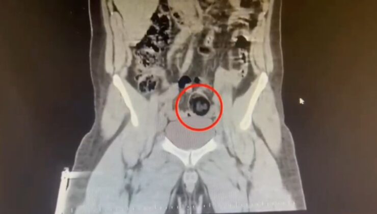 Kars’ta İranlı yolcu makatında uyuşturucuyla yakalandı