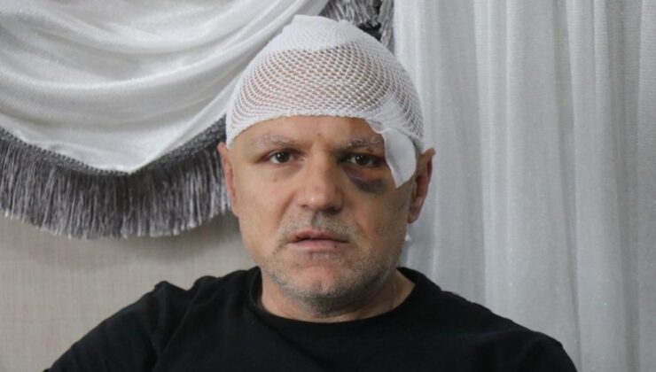 Sakarya’da öldüresiye dövülen tekel bayii işletmecisi: Ölümü bekledim